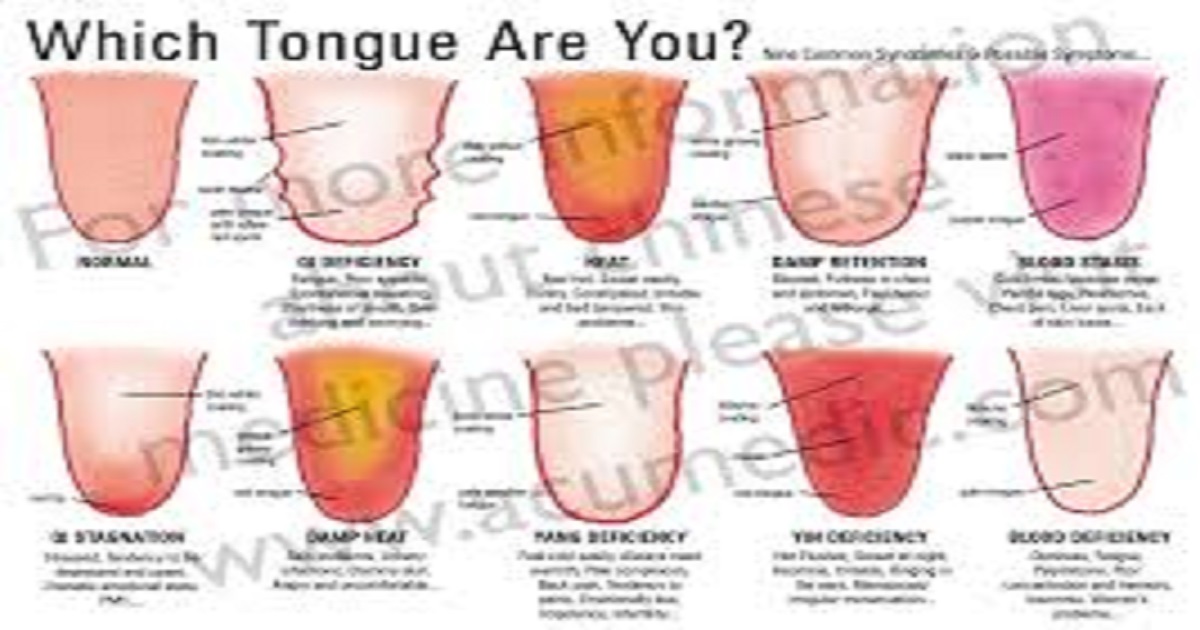 Tongue Health Chart